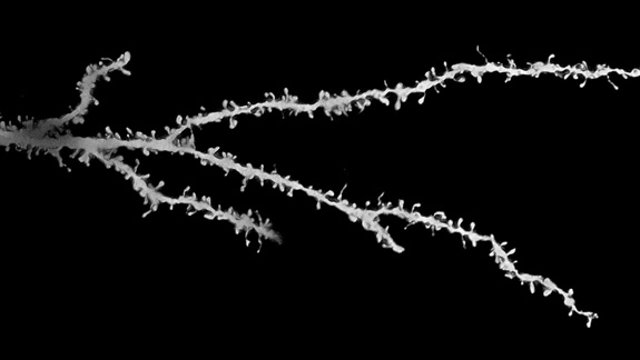 A new study finds that children with autism have extra synapses, which can affect how the brain functions. Synapses connect neurons, like the one pictured, to each other. (Guomei Tang, PhD and Mark S. Sonders, PhD/Columbia University Medical Center)